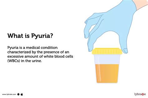 Pyuria: Definition, causes, and treatment .